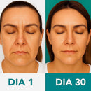 Massageador Facial com Fototerapia Anti-Rugas DermaLift